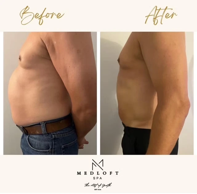 XR7 Muscle Stimulation