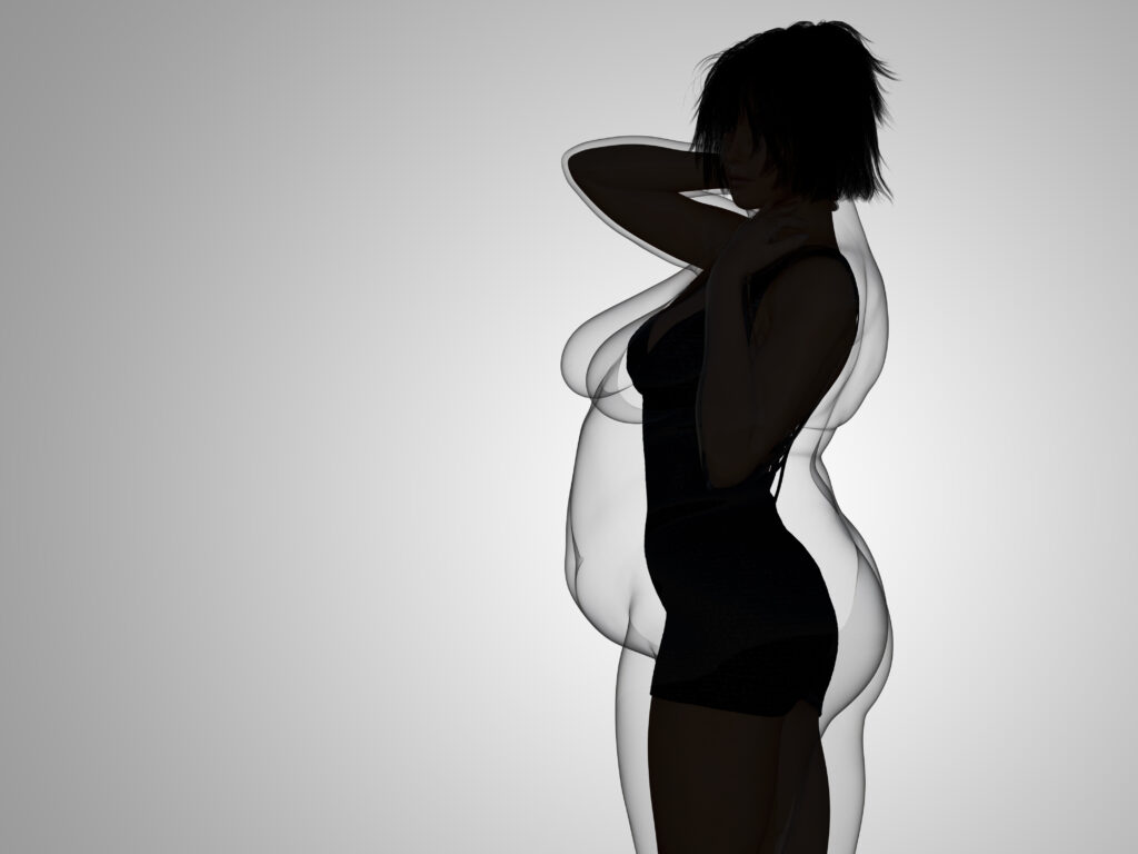 Weight Loss Programs